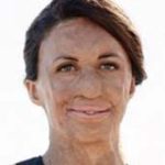 Turia Pitt